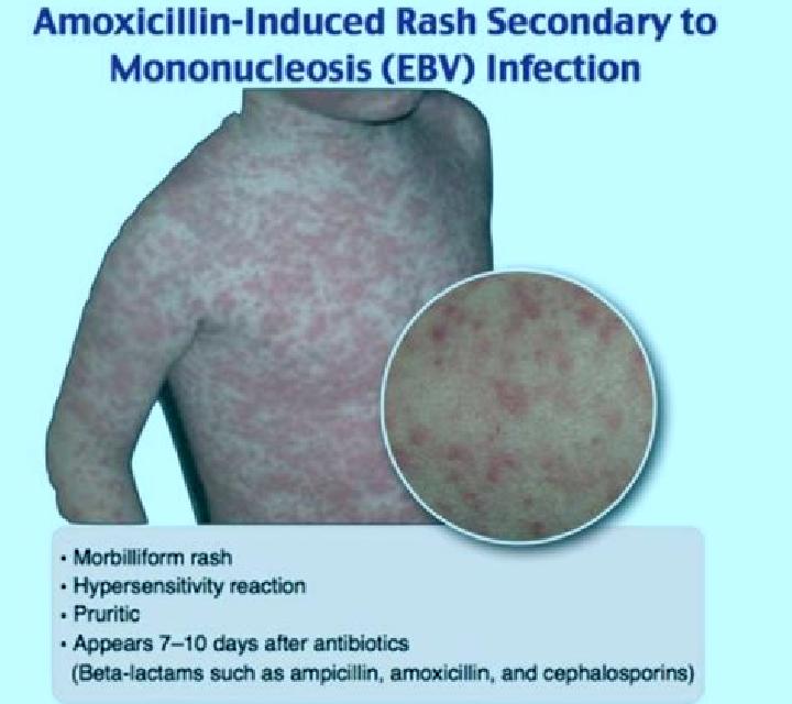 Celexa celexa adderall xr pills