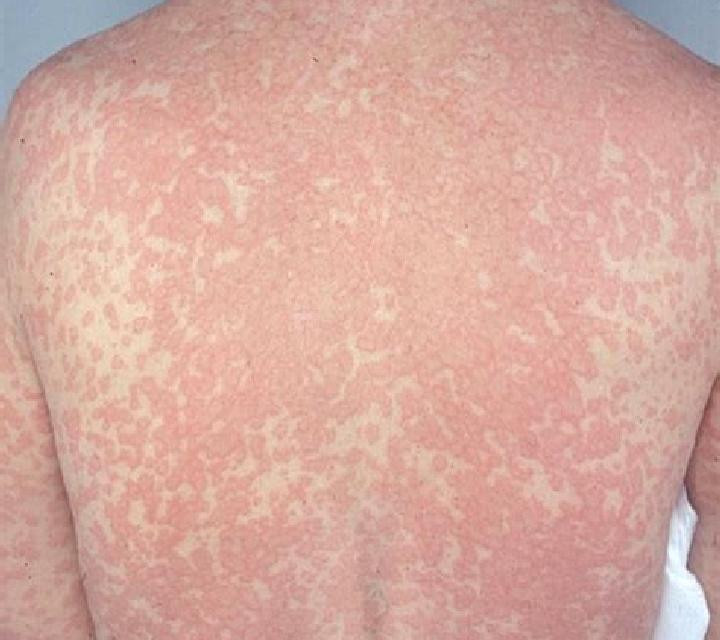 Kamagra what is kamagra gel tablet